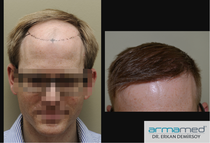 index.php/fa/22562/0/