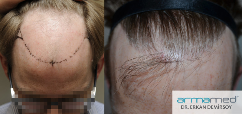 index.php/fa/22563/0/