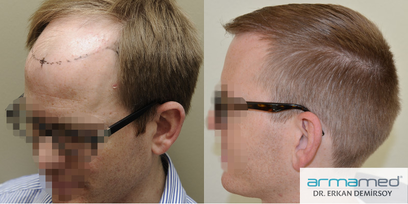 index.php/fa/22564/0/