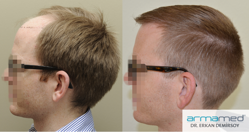 index.php/fa/22565/0/