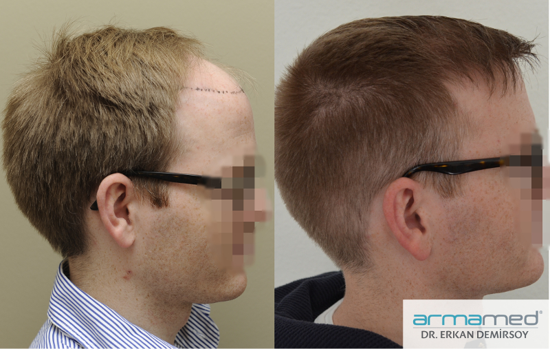 index.php/fa/22567/0/