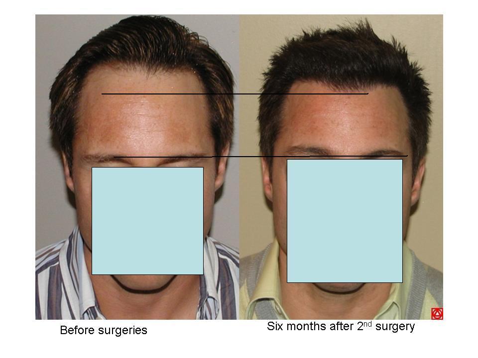 index.php/fa/2287/0/