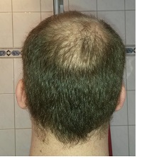 index.php/fa/22939/0/