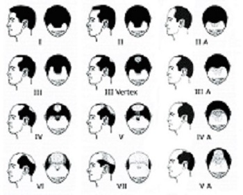 index.php/fa/22940/0/