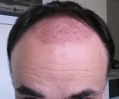 index.php/fa/22944/0/