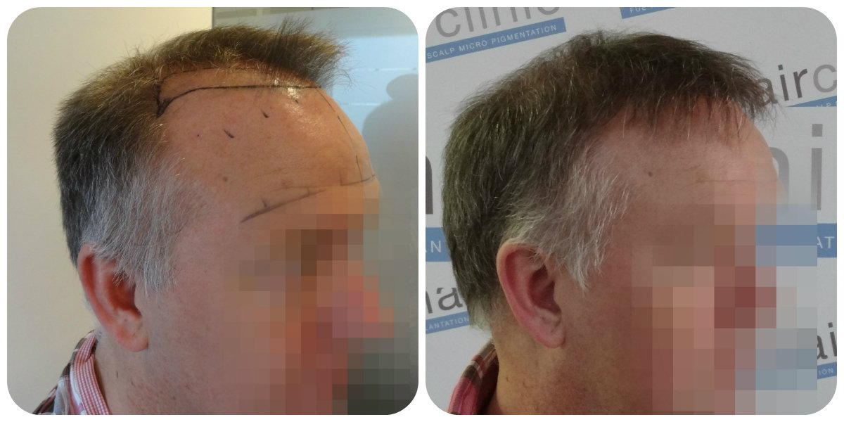 index.php/fa/23110/0/