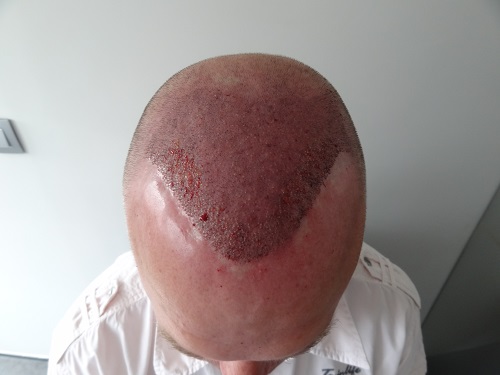 index.php/fa/23111/0/