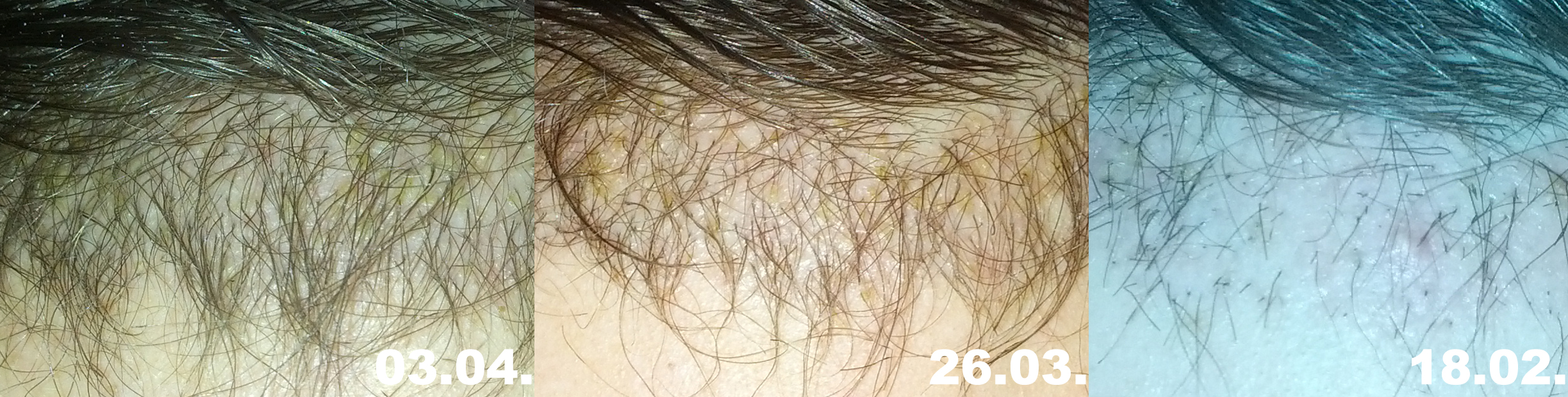 index.php/fa/23403/0/