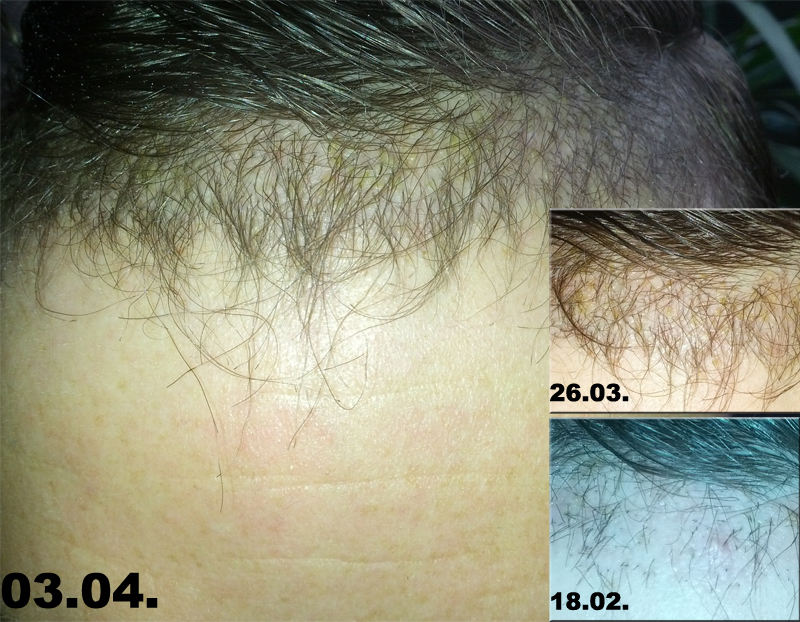 index.php/fa/23404/0/