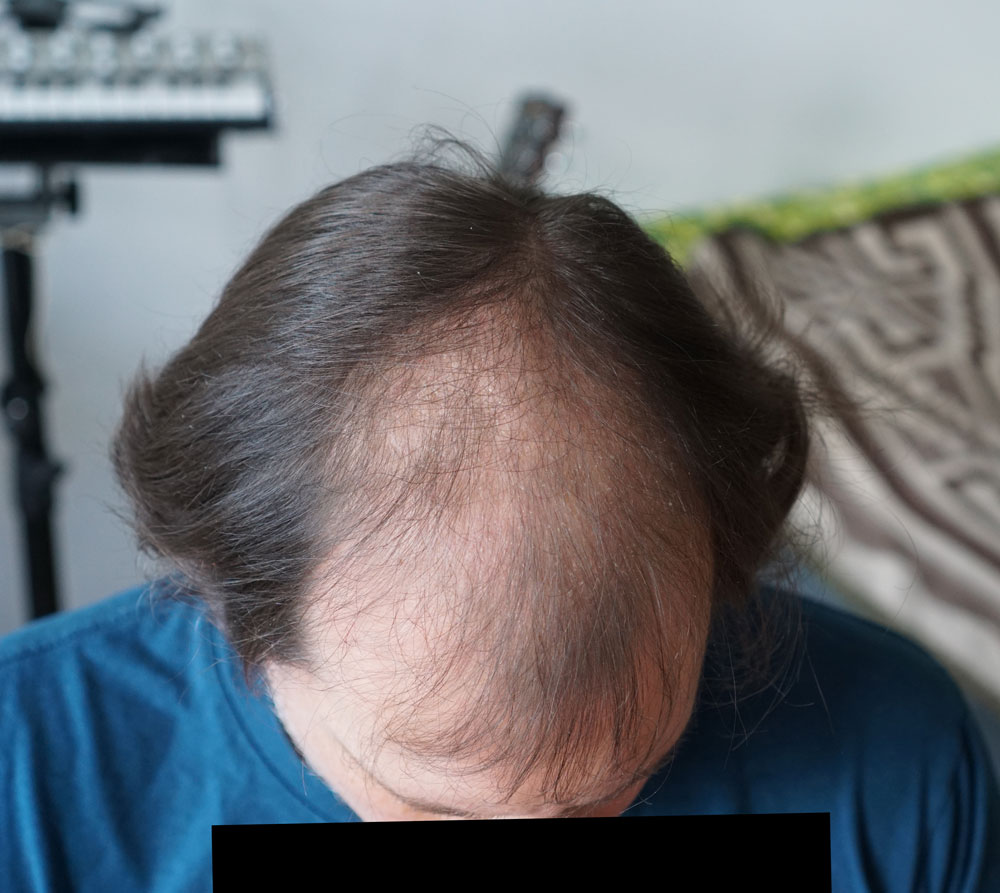 index.php/fa/23413/0/