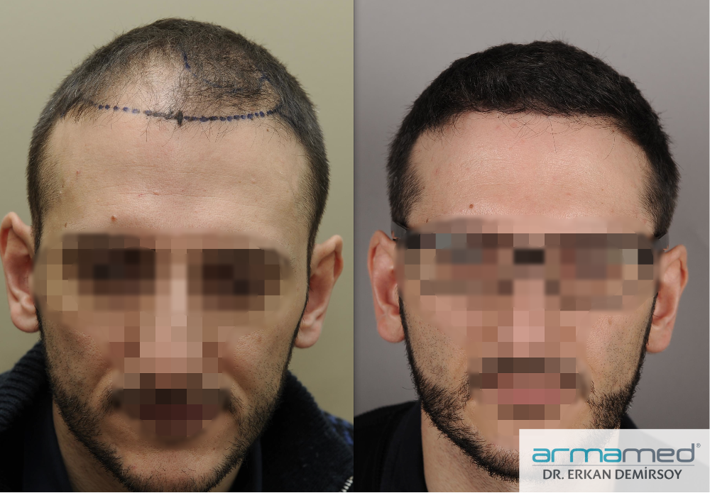 index.php/fa/23433/0/