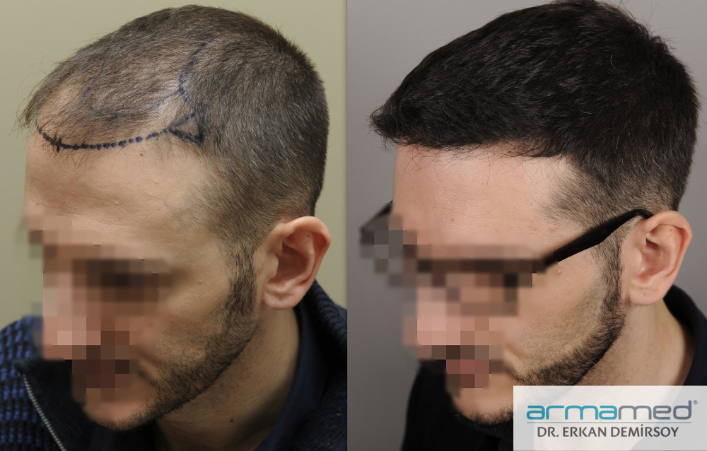 index.php/fa/23435/0/