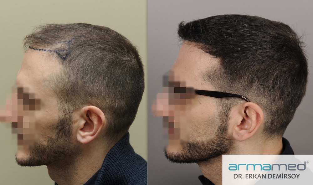 index.php/fa/23436/0/