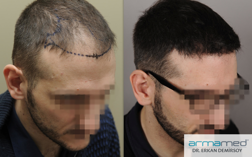 index.php/fa/23437/0/