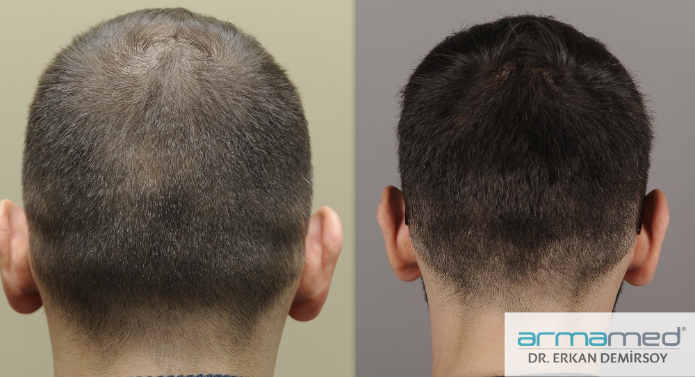 index.php/fa/23439/0/