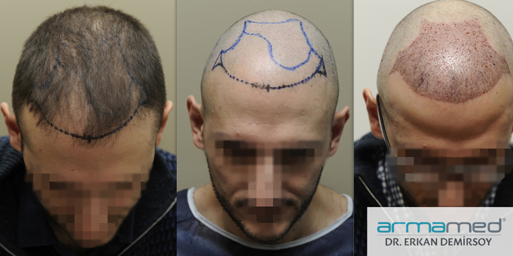 index.php/fa/23440/0/