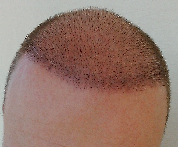 index.php/fa/23567/0/