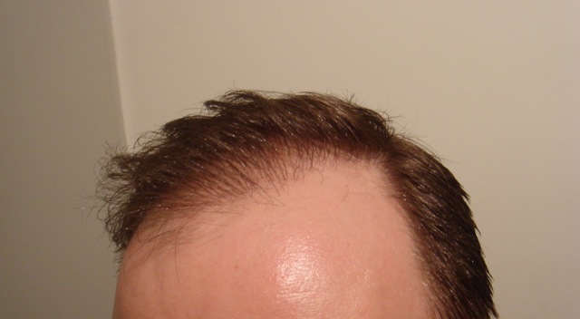 index.php/fa/2361/0/