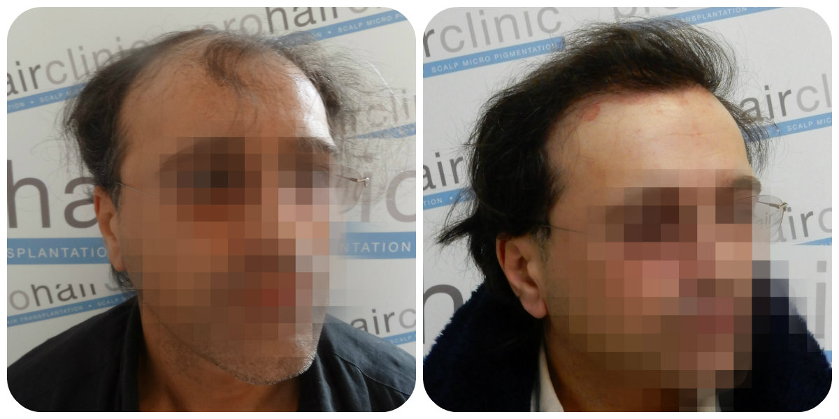 index.php/fa/23802/0/