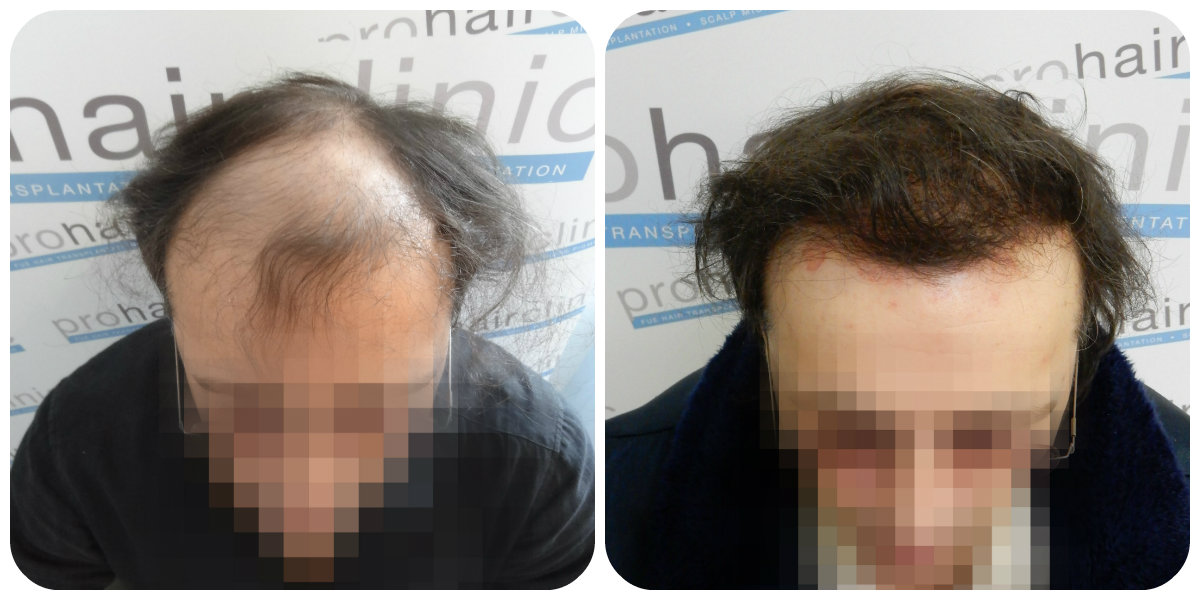 index.php/fa/23803/0/