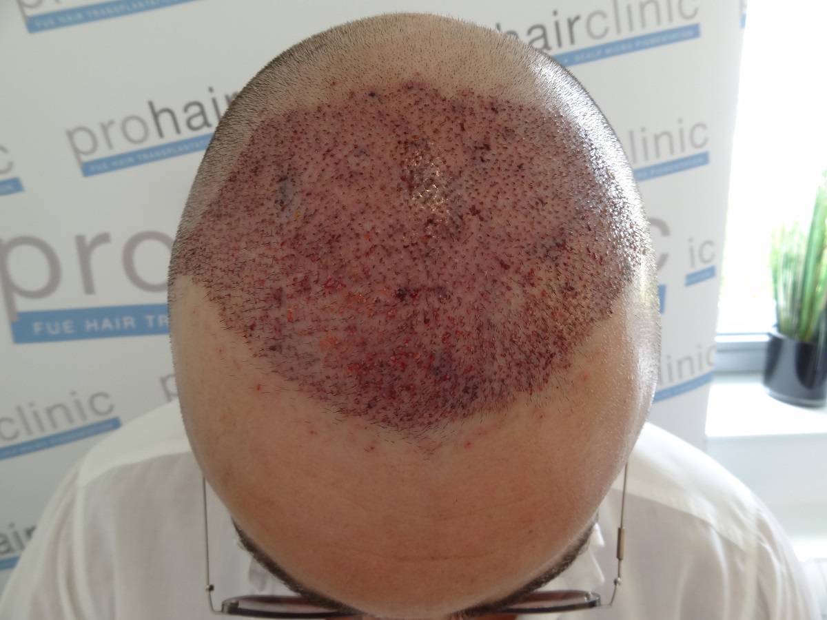 index.php/fa/23804/0/