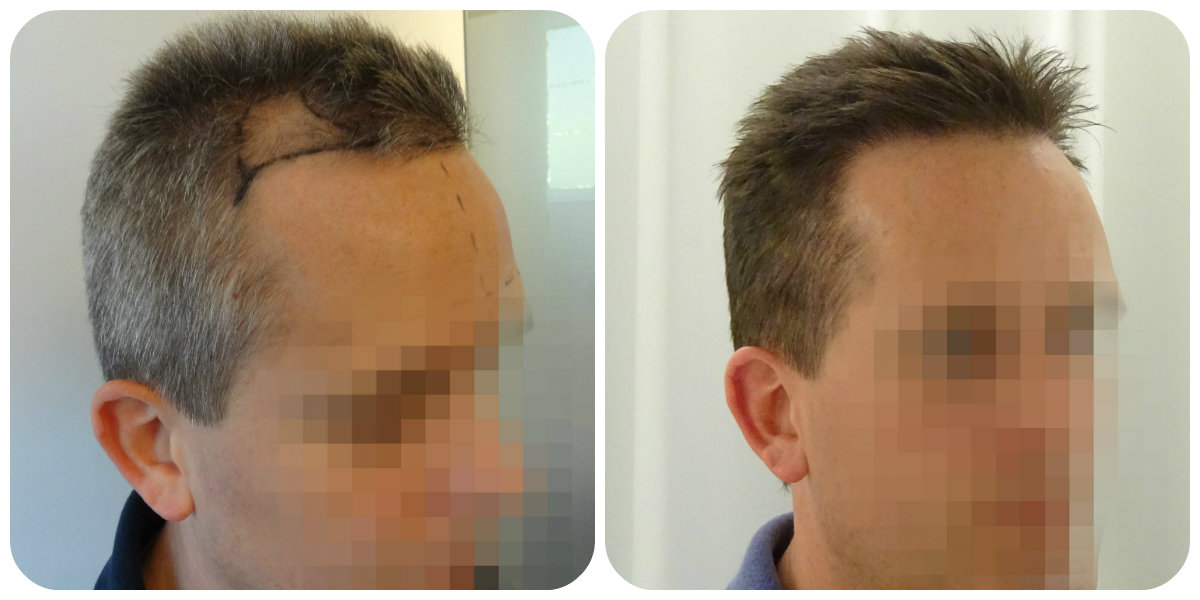 index.php/fa/23875/0/