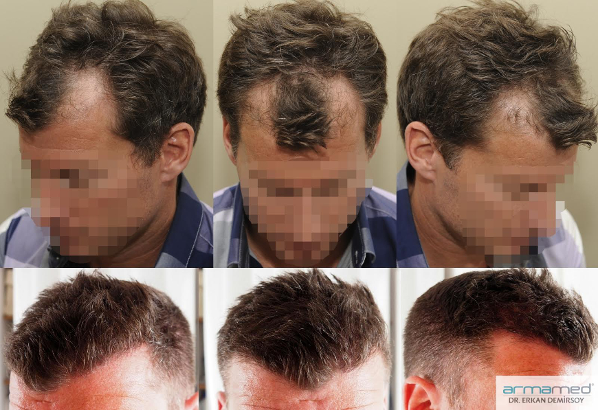 index.php/fa/24313/0/