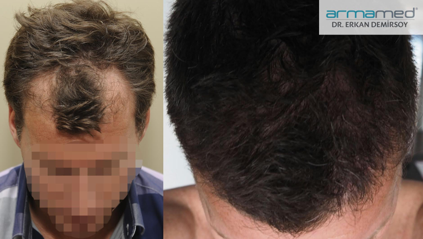 index.php/fa/24314/0/