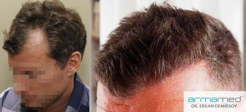 index.php/fa/24315/0/