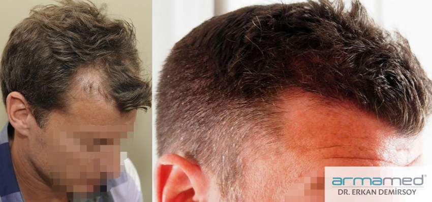 index.php/fa/24316/0/