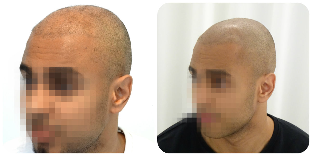 index.php/fa/24344/0/