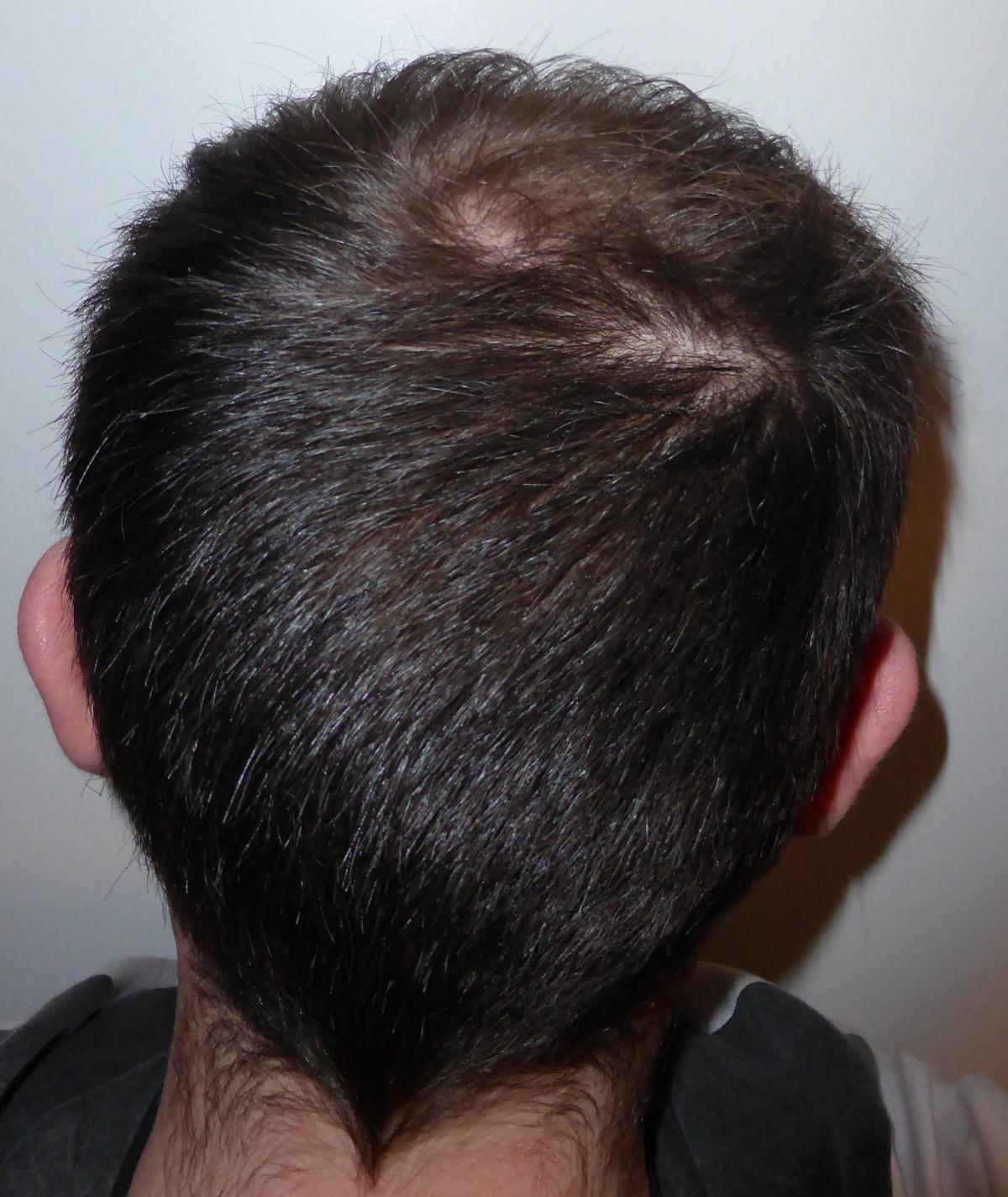 index.php/fa/24409/0/