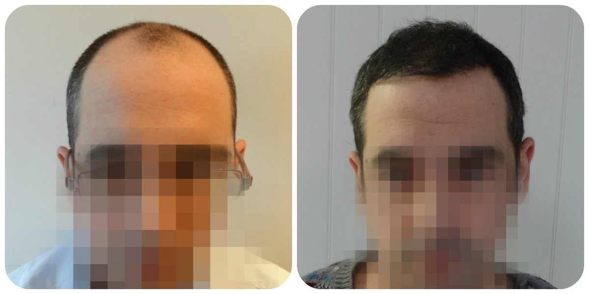 index.php/fa/24445/0/