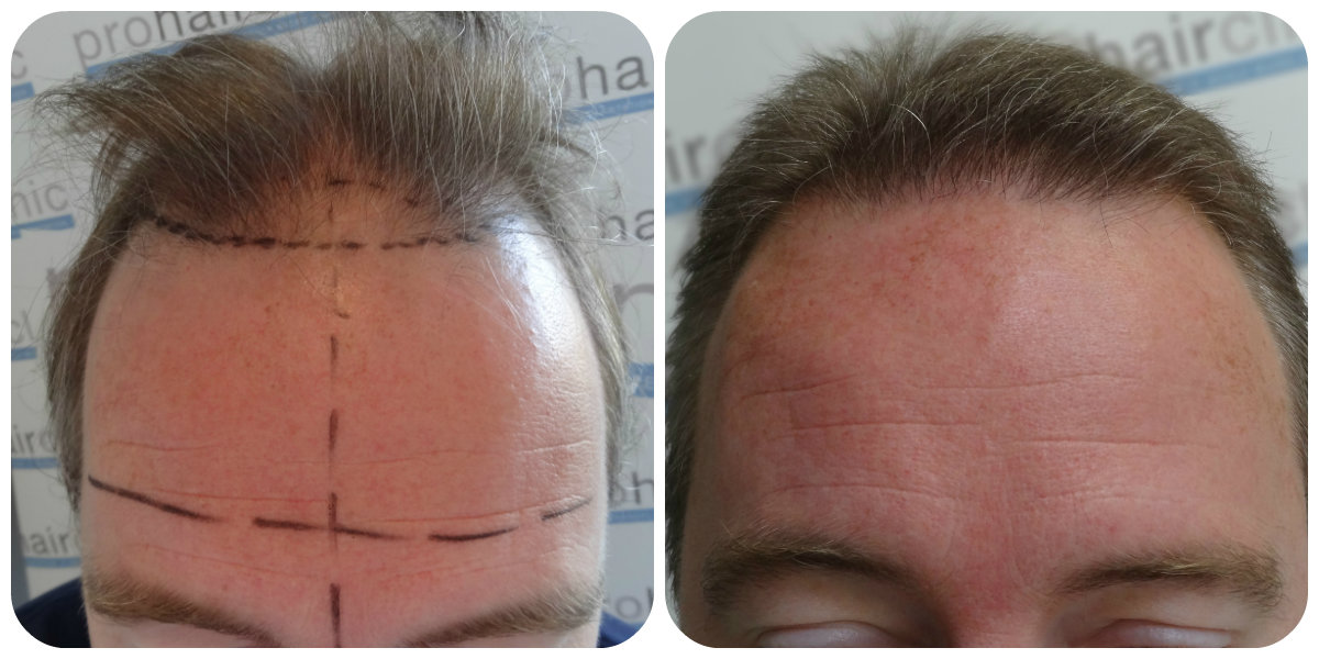 index.php/fa/24564/0/