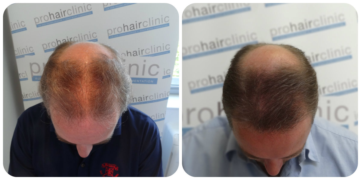 index.php/fa/24567/0/