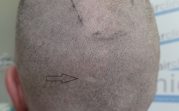 index.php/fa/24579/0/