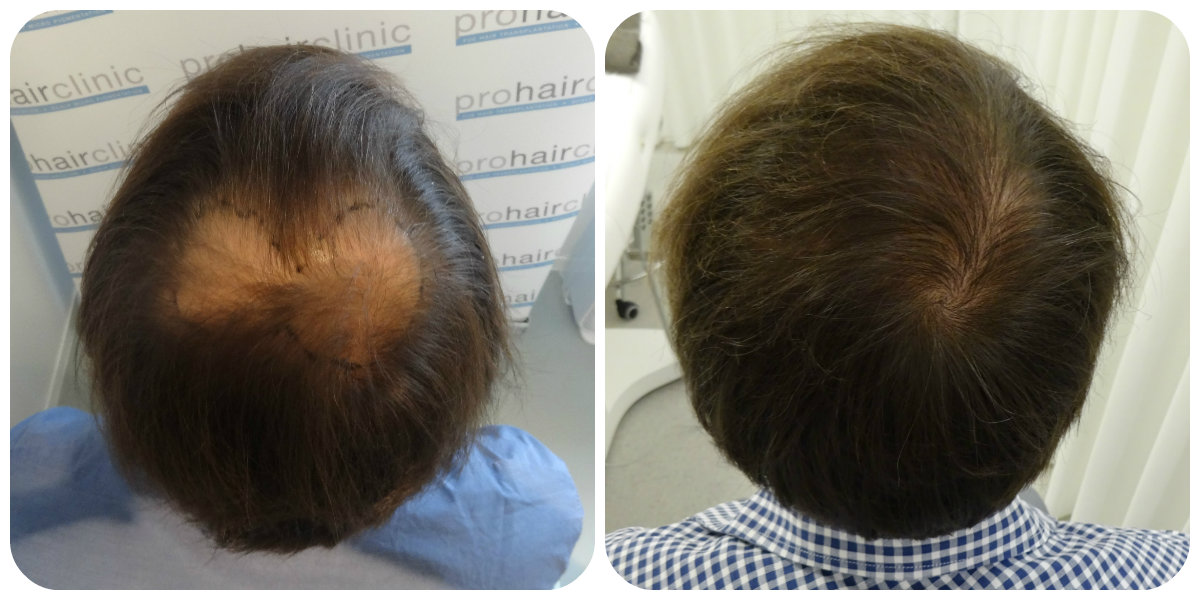 index.php/fa/24582/0/