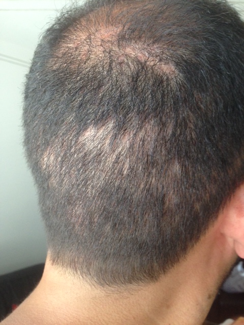 index.php/fa/24883/0/