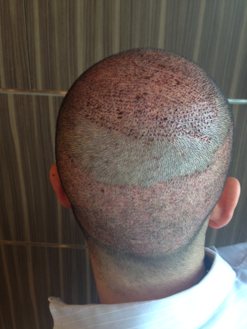 index.php/fa/24887/0/