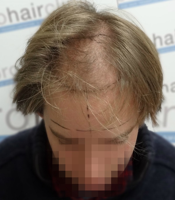 index.php/fa/24955/0/