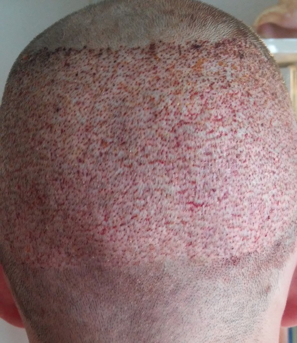 index.php/fa/24958/0/