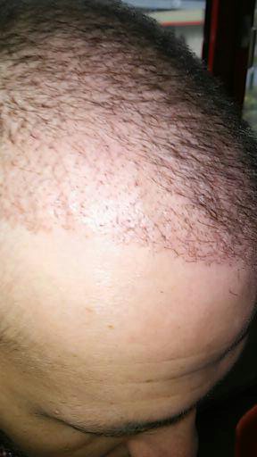 index.php/fa/24961/0/