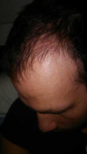 index.php/fa/24962/0/