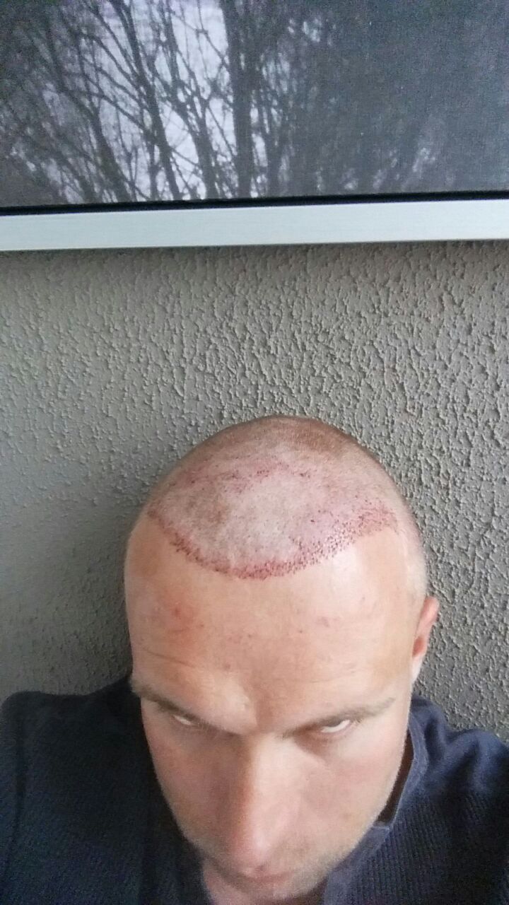 index.php/fa/24983/0/