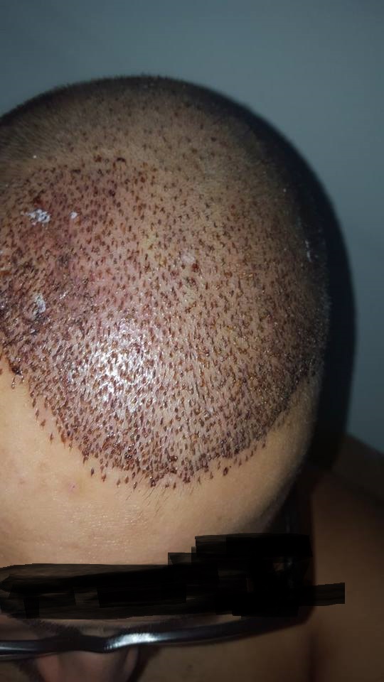 index.php/fa/25010/0/