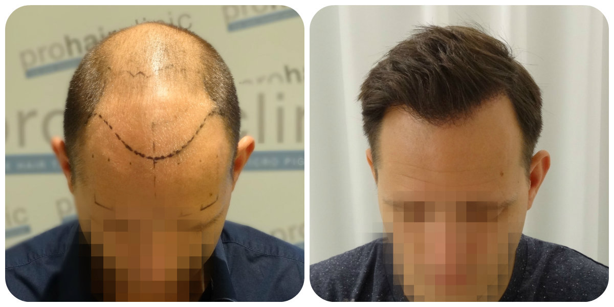 index.php/fa/25436/0/