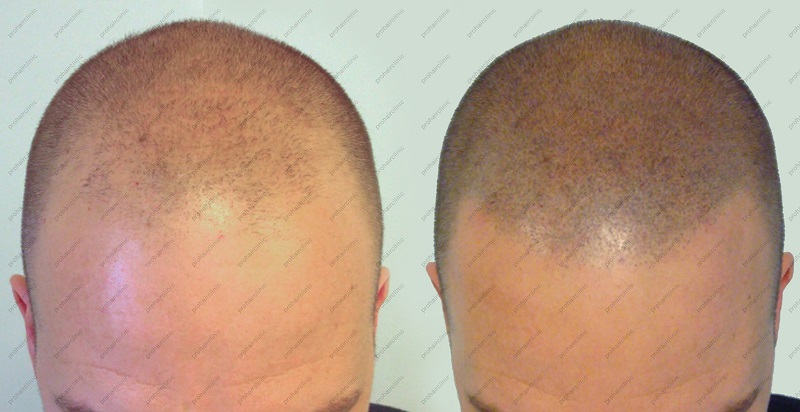 index.php/fa/25450/0/