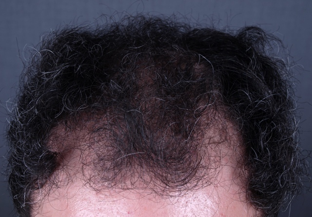 index.php/fa/2571/0/