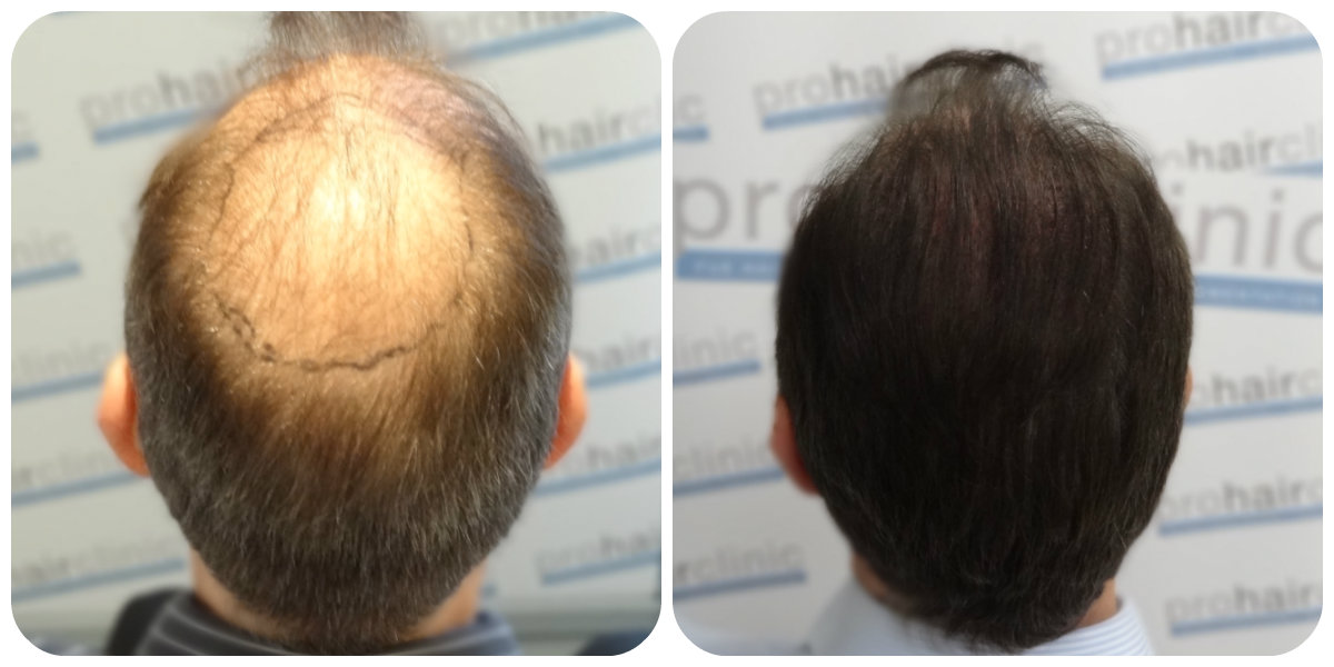 index.php/fa/25887/0/