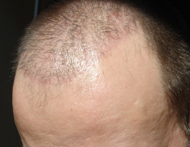 index.php/fa/2600/0/